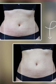 نتایج دستگاه em در کمتر از یک ماه در اکسیر شهرک غرب